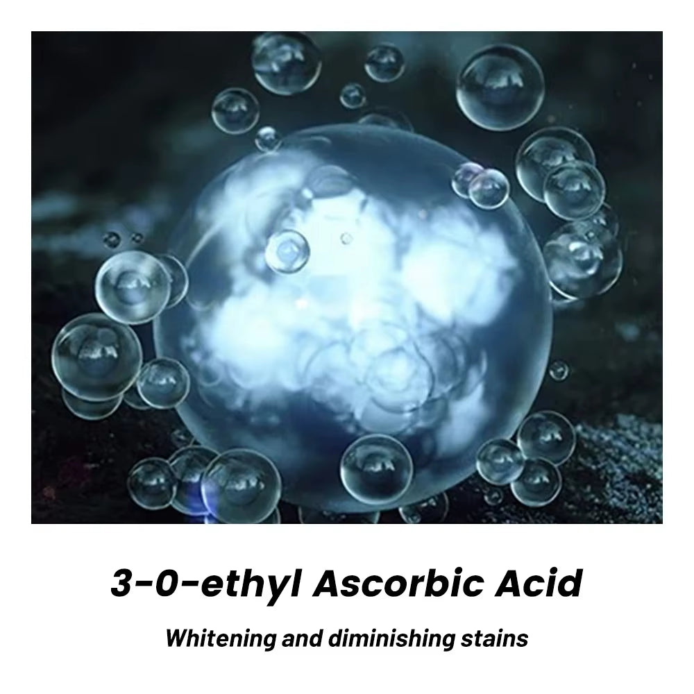 20G Whitening Freckle Cream Remove Dark Spot Cream anti Freckle and Aging Cream Fade Pigmentation Melasma Brighten Serum Skin