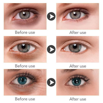Instant Remove Wrinkles Retinol Face Cream Lifting anti Aging anti Eye Bags Moisturizer Facial Treatment Korean Care